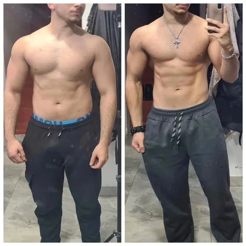 Comparación de un paciente: antes y después de cambiar su composición corporal